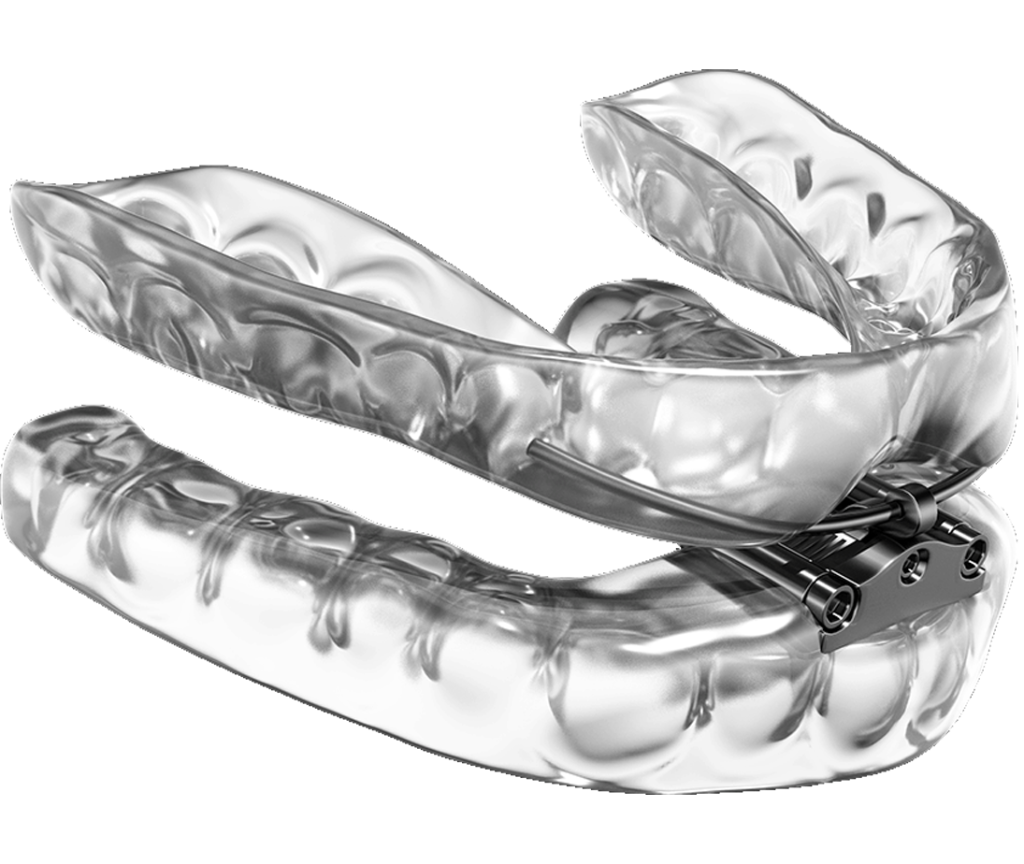 Image of clear DreamTAP mouthpiece